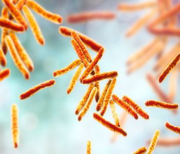 9 Cách làm giảm Vi khuẩn trong nhà máy Thực phẩm