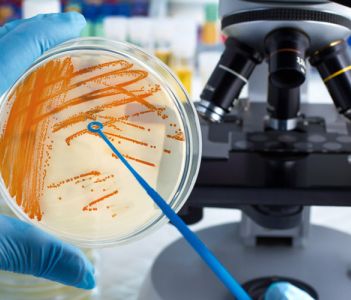 [2024] Kiểm nghiệm vi sinh thực phẩm là gì? Các phương pháp và xu hướng kiểm nghiệm mới