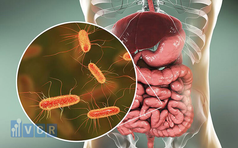 E.Coli cũng nằm trong danh sách các loại vi sinh vật chỉ thị.